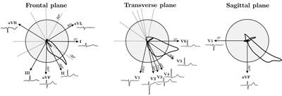 The art of selecting the ECG input in neural networks to classify heart diseases: a dual focus on maximizing information and reducing redundancy